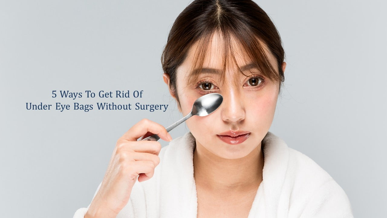 How To Remove Eyebags Naturally Without Surgery