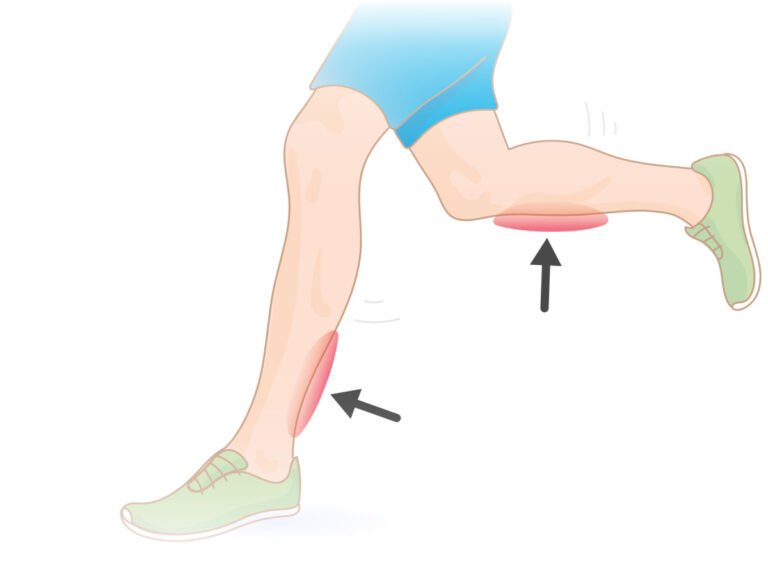 ow to Manage Ankle Pain Running After a Run