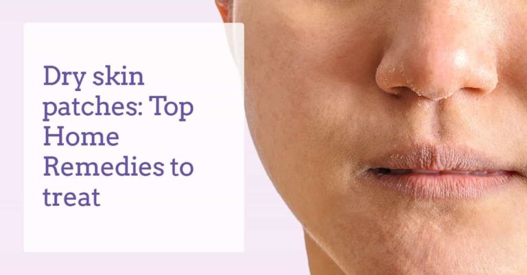 How to Treat Dry Patches on the Skin