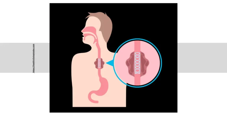 Primary Symptom of Achalasia