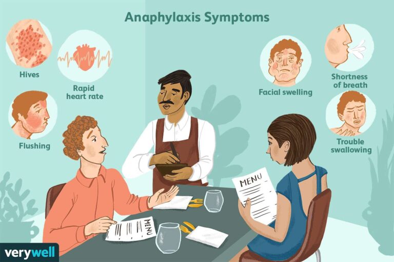 Food Allergy Symptoms