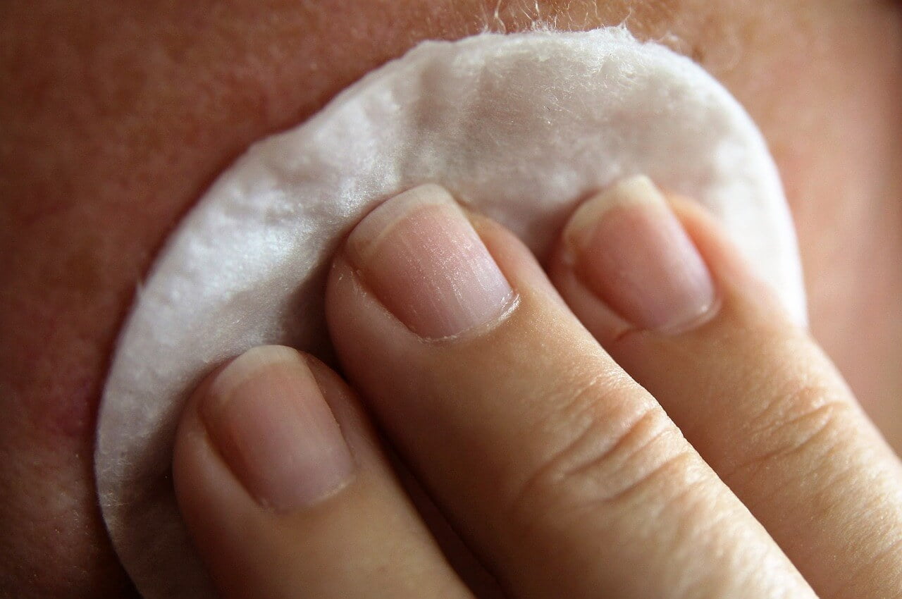 How to Get Rid of Pimples under the Skin Naturally