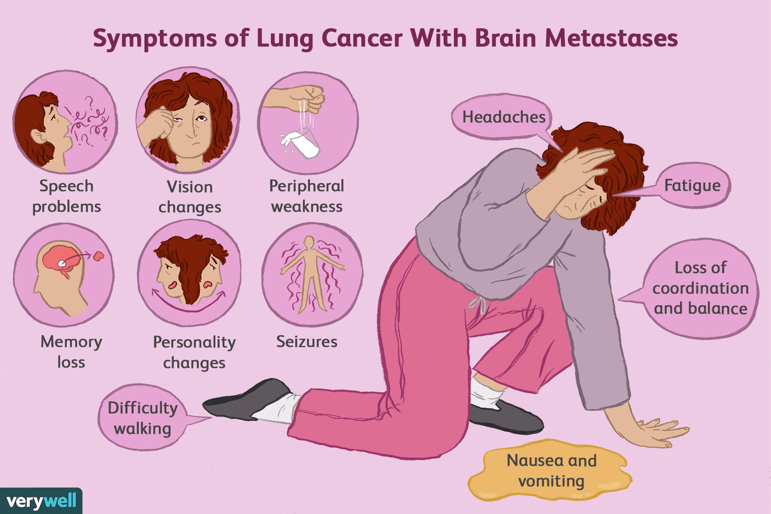 When Cancer Spreads to the Brain How Long to Live